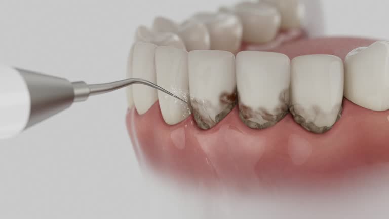 Reliable Emergency Dentist contractor in Pierce, NE by Smile Center Dentistry